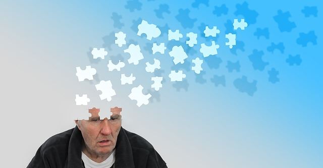 阿茲海默症早篩有望 腦循環系統中的生物標記 