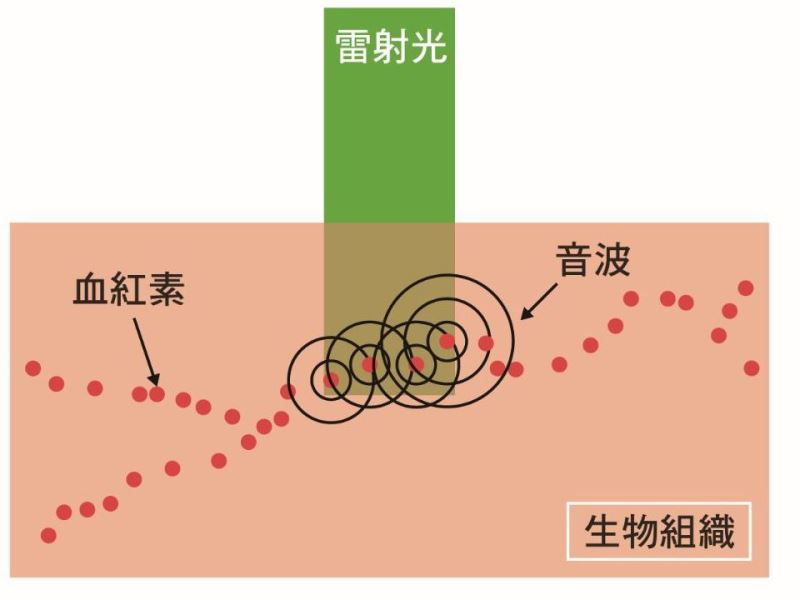 光聲顯微鏡─聽出微觀的生命世界 