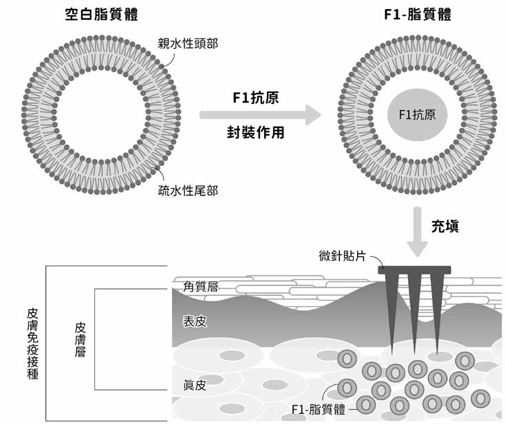 與「鼠疫」的防治角力 不為人所知的上古疾病與預防策略