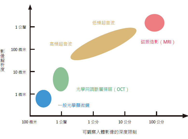 超解析超音波影像 