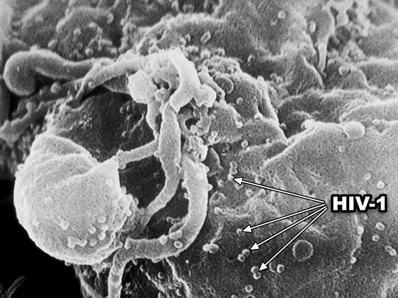 揭開致病原的面紗—人類乳突病毒與愛滋病毒