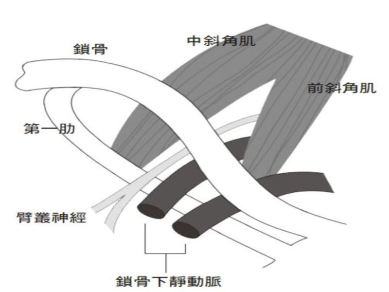 電腦族的殺手──胸廓出口症候群