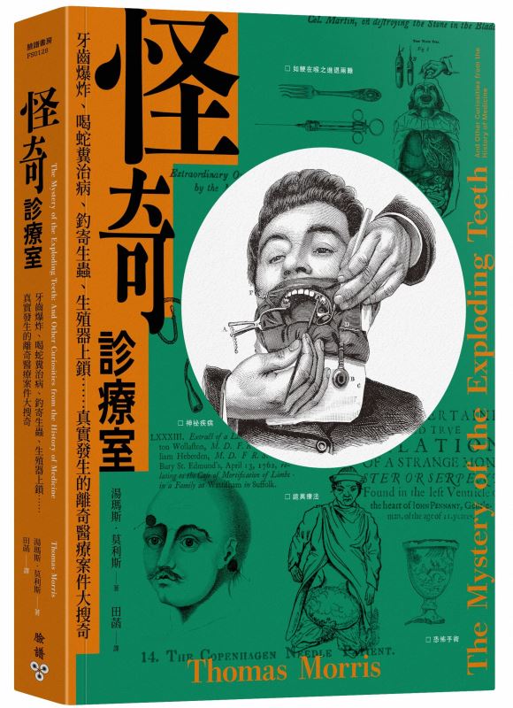 怪期診療室 牙齒爆炸、喝蛇糞治病、釣寄生蟲、生殖器上鎖……真實發生的離奇醫療案件大搜奇