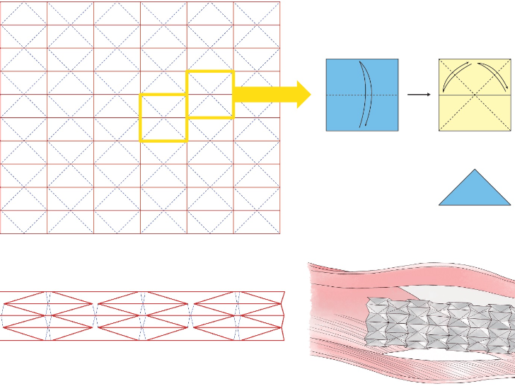 「摺」出血管支架、太陽能板 結合藝術與科學的摺紙數學