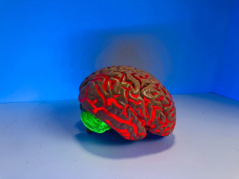 結合腦部MRI與基因資料 建構AI模型分析阿茲海默症腦部特徵