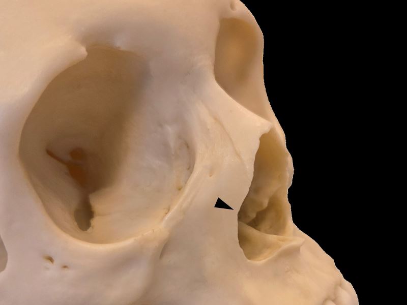 古代人類長怎樣？結合科學、文化與藝術的顱面復原