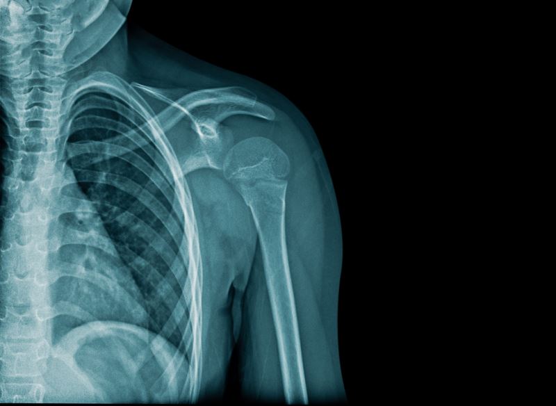 新晶體「相機」突破 醫學影像更清晰 