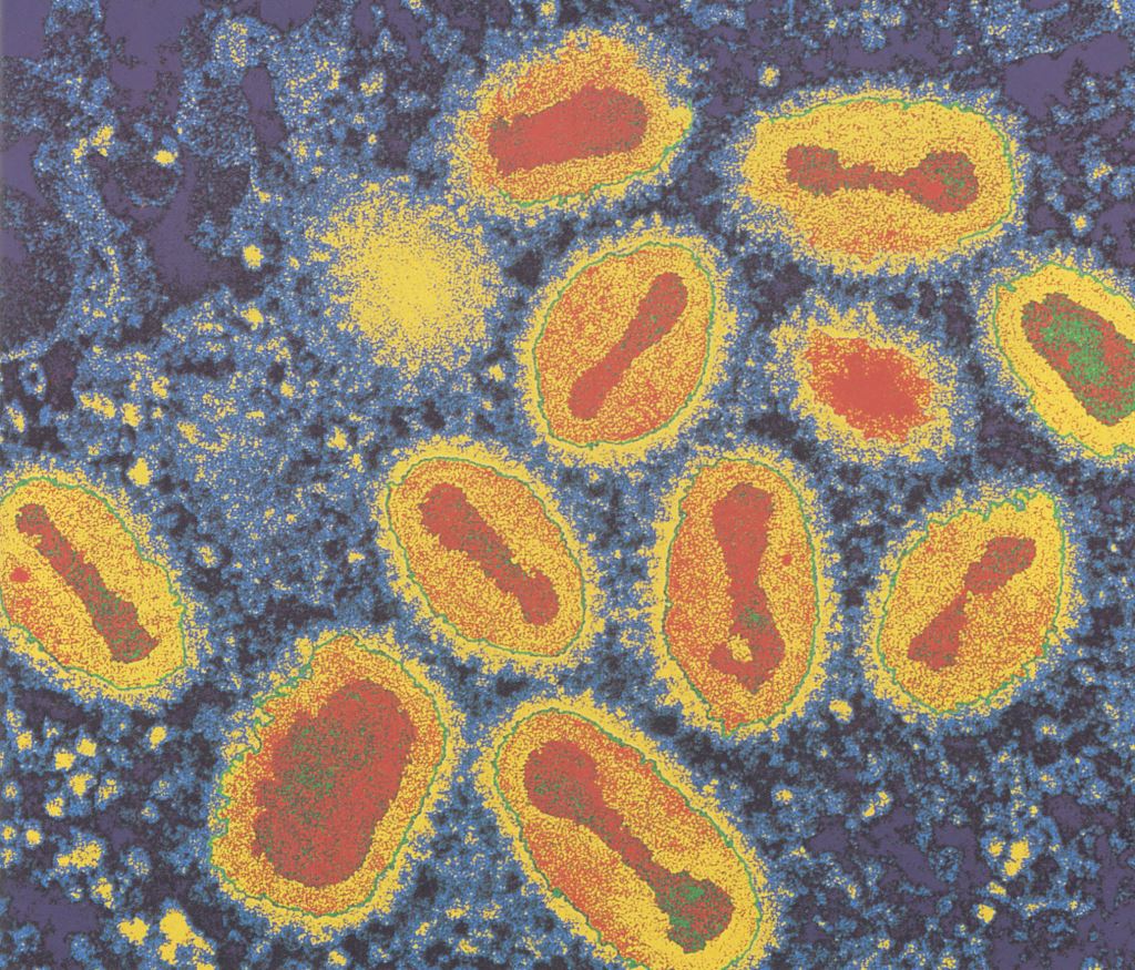 图一:天花病毒.